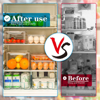 Stackable Fridge Organizer Set – 10 Clear Storage Boxes for Freshness & Kitchen Order