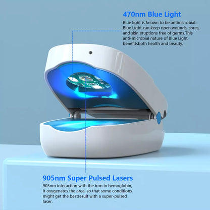 Nail Fungus Laser Treatment Device | Dual Wavelength Therapy 905nm & 470nm